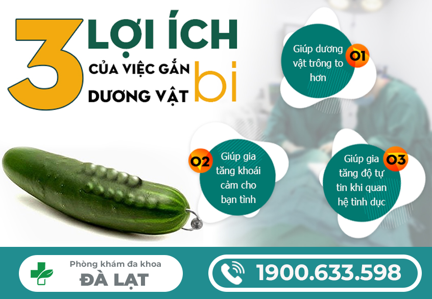 Hình ảnh minh họa